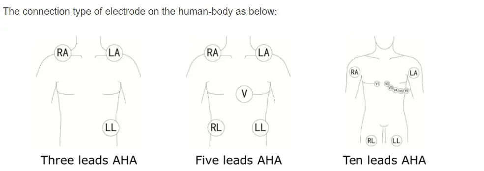 5-vezetékes EKG-vezetékek philips digitrak plusz 24 órás holter 3100A, 5-vezetékes, Snap